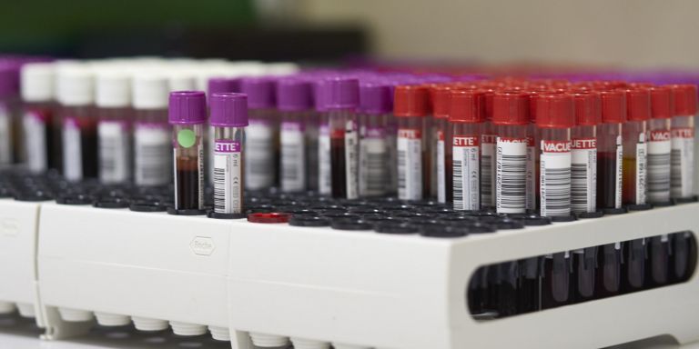 Viele Blutproben zur Untersuchung bereit