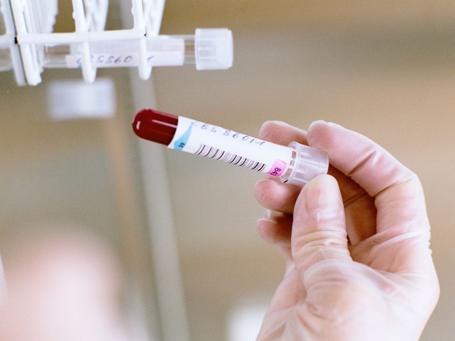 Das Bild zeigt eine Blutprobe im Labor in einem beschrifteten Röhrchen, das eine Person hält. 